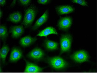 (ibidi) μ-Dish 35 mm培養(yǎng)皿-81156 81151 80136 80131 81158